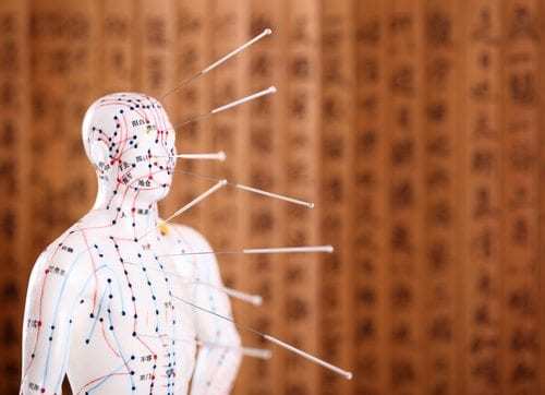 Eastern or Asian acupuncture Medical Treatment.