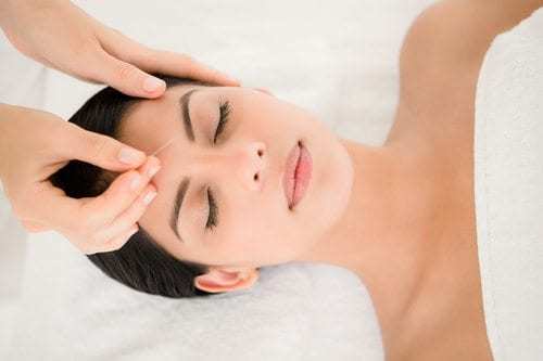 Woman in an acupuncture therapy at the health spa