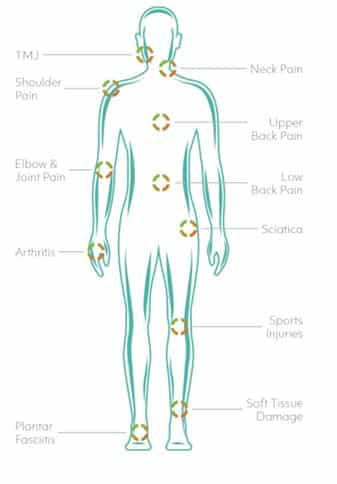 Cold laser treatment chart